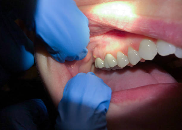 Best Emergency Dentist for Special Needs Patients in Park Hill, OK
