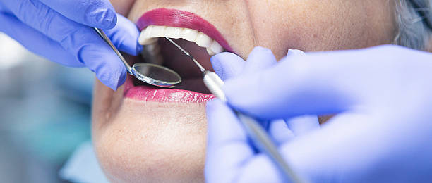 Best Emergency Dentist for Knocked-Out Tooth in Park Hill, OK